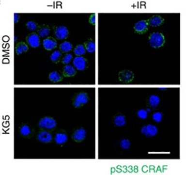 CRAF-Driving Tumor Radioresistance graph