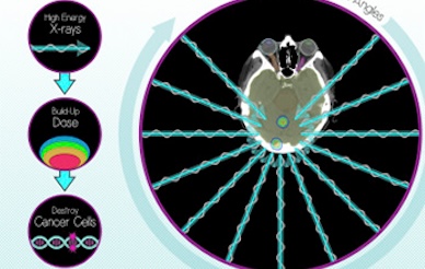 cancer cell and xray graph